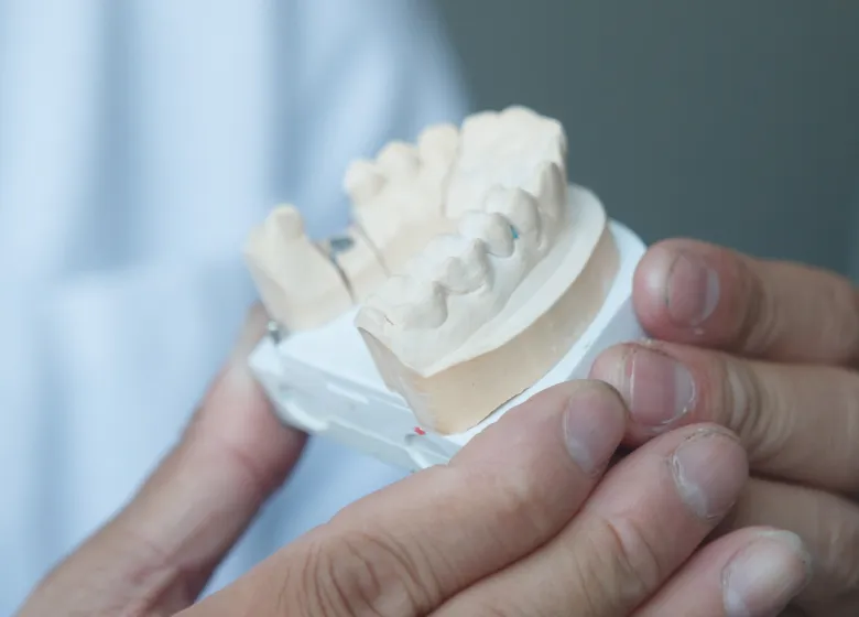 02 歯の形状や寸法を正確に把握するために患者様の歯の型取りを行います。